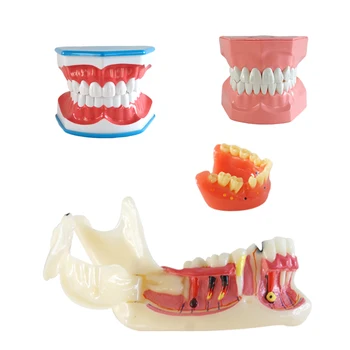 Dantų Dantų Modelio Dantų Mokymo Modelį Dantų Valymas Modelis su Liežuviu Odontologinės Medžiagos